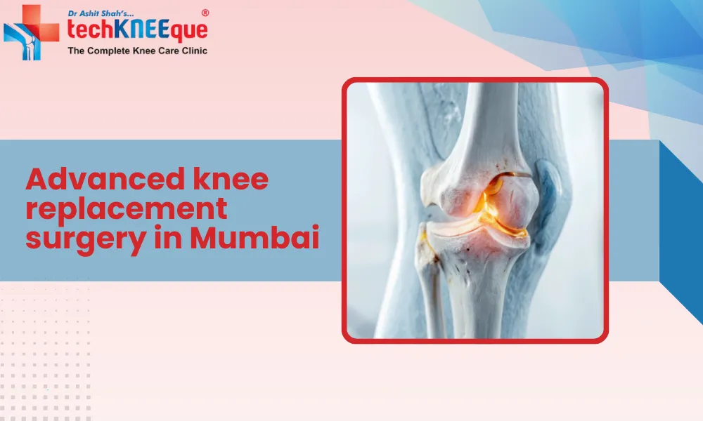 Advanced Knee Replacement Surgery in Mumbai