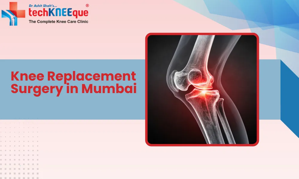 Knee Replacement Surgery in Mumbai