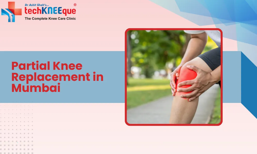 Partial Knee Replacement in Mumbai